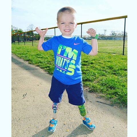 Photo 6 from Amputee Coalition of America, Inc.