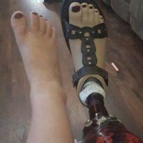 Photo 2 from Amputee Coalition of America, Inc.