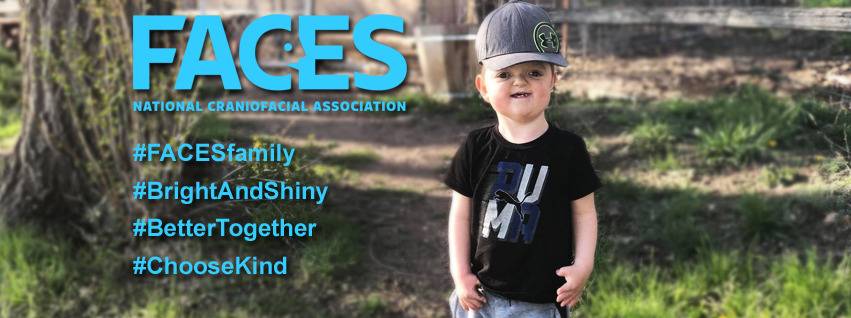 FACES THE NATIONAL CRANIOFACIAL ASSOCIATION
