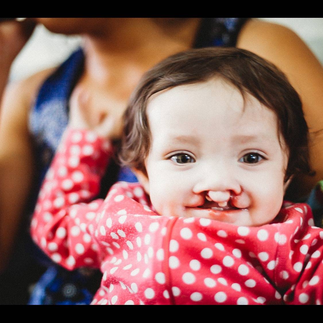 Photo 4 from Austin Smiles - The Austin Plastic Surgery Foundation