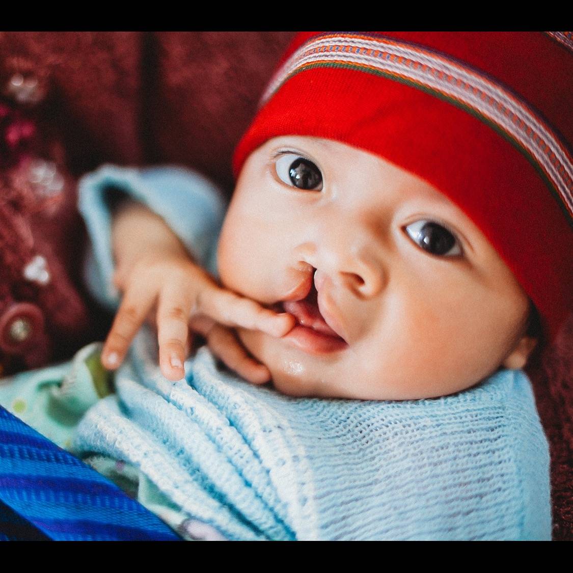 Photo 8 from Austin Smiles - The Austin Plastic Surgery Foundation