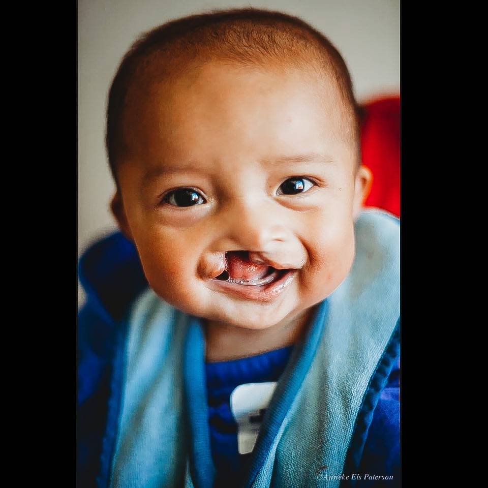 Photo 10 from Austin Smiles - The Austin Plastic Surgery Foundation