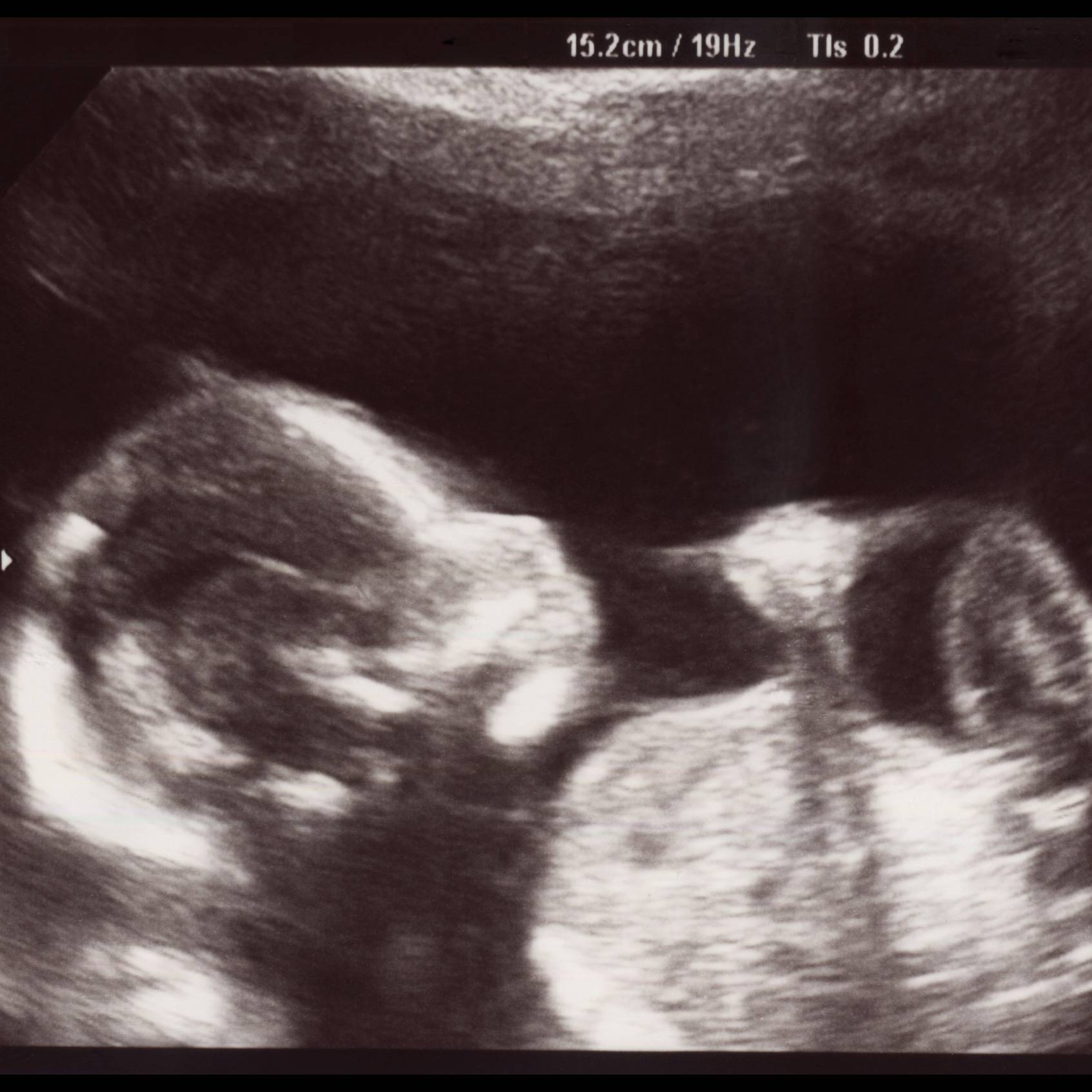 Photo 9 from WOMEN'S HELP CENTER