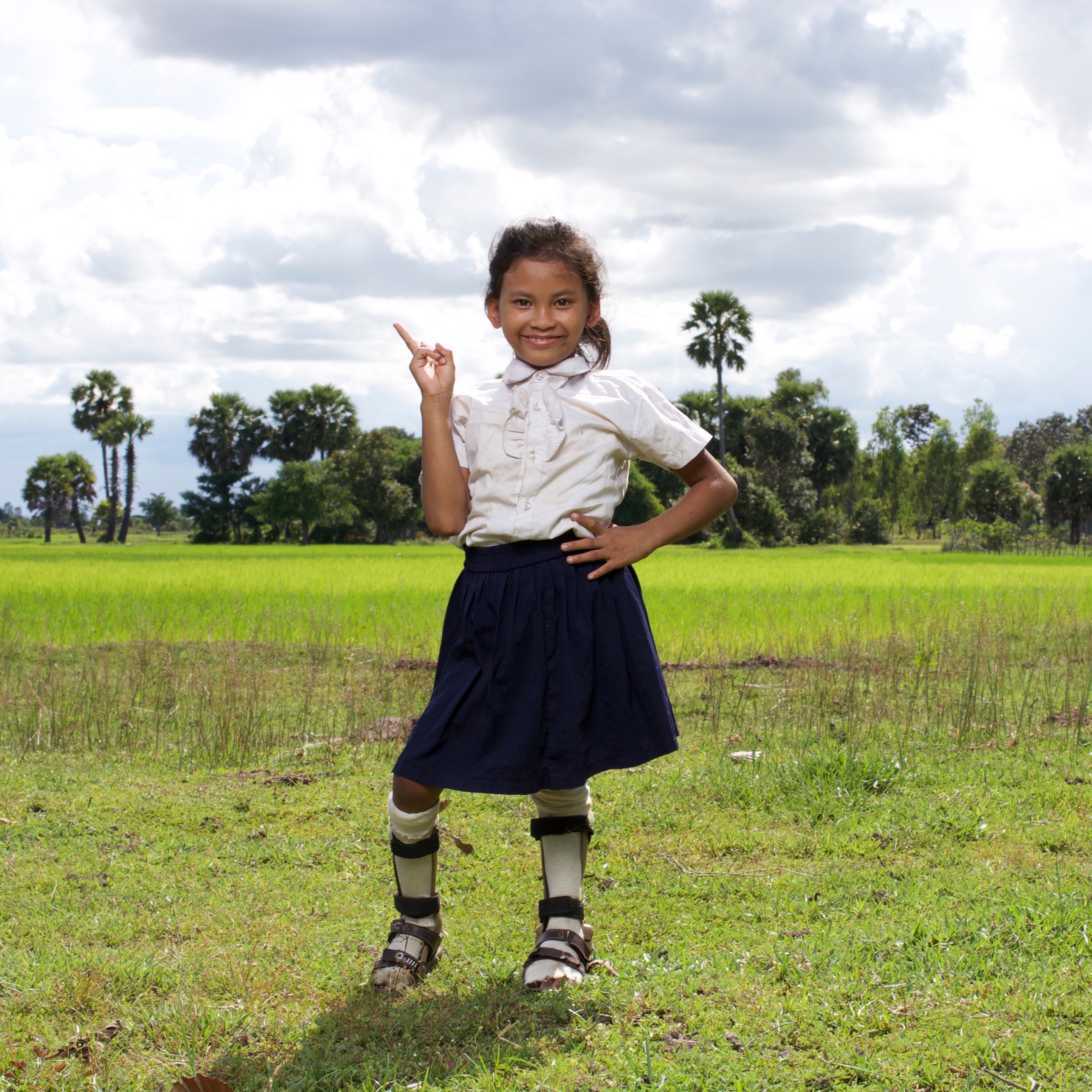 Photo 2 from A LEG TO STAND ON