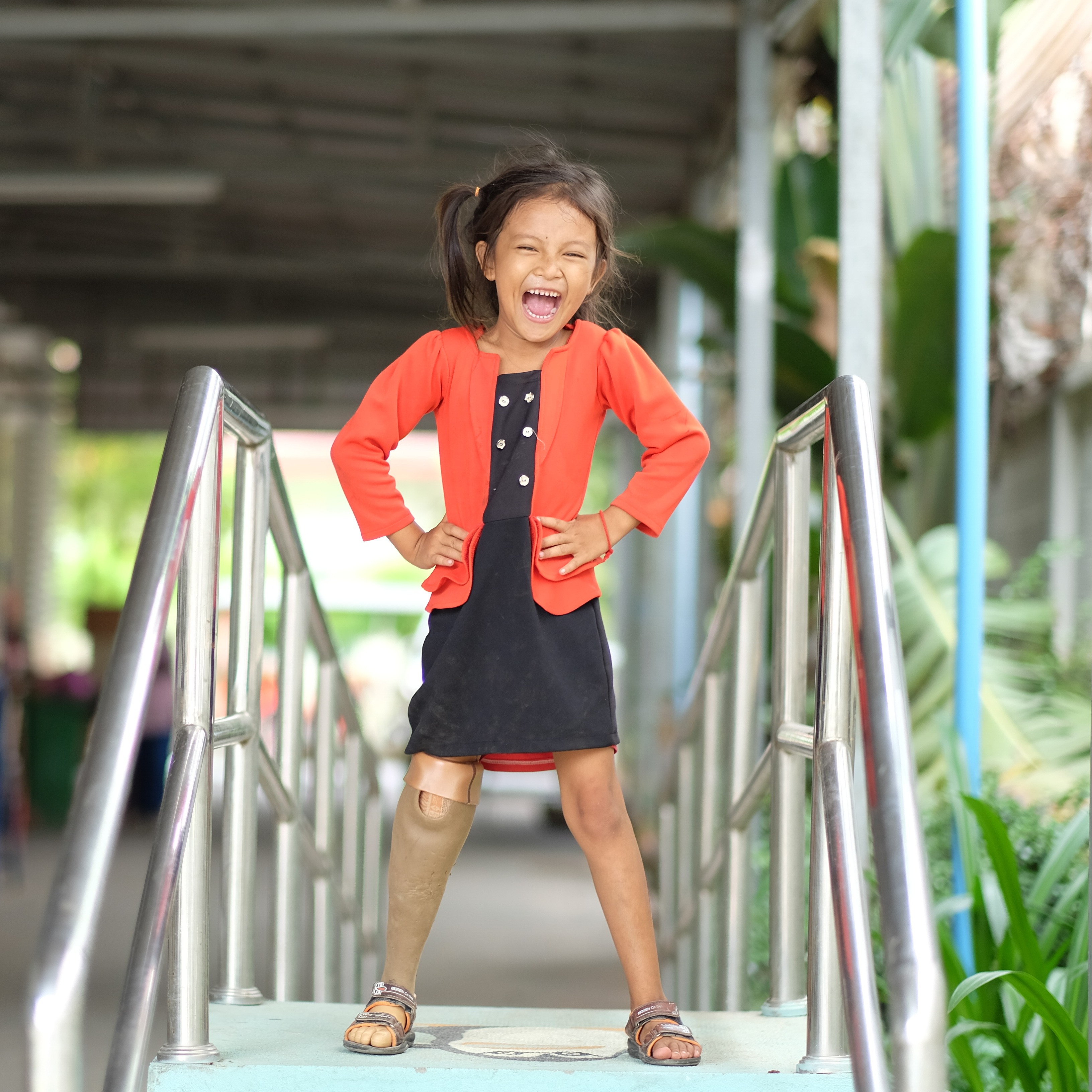 Photo 3 from A LEG TO STAND ON