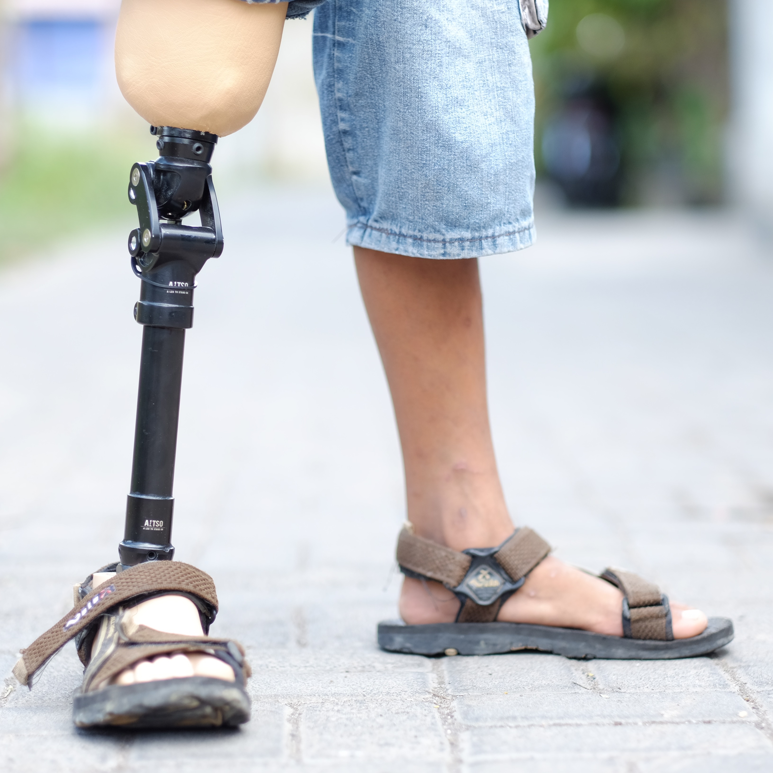 Photo 5 from A LEG TO STAND ON