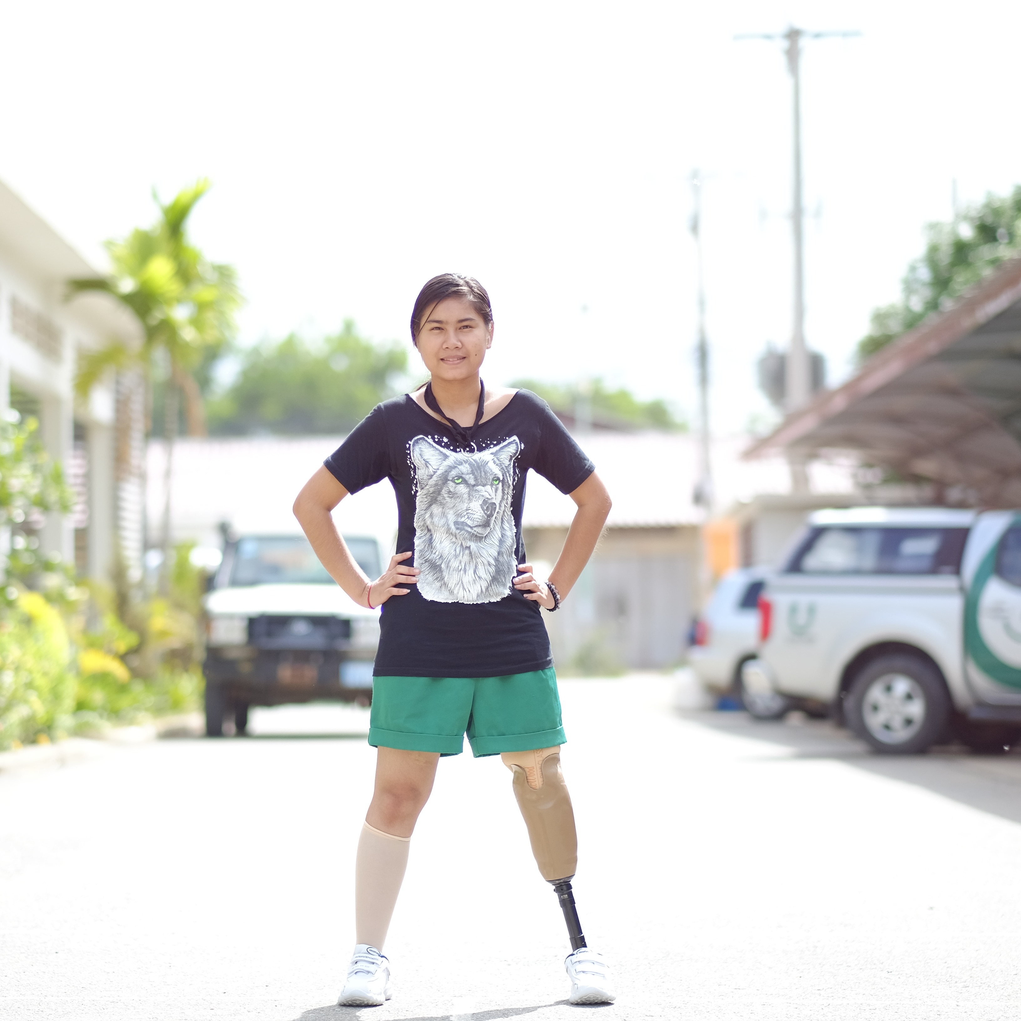 Photo 6 from A LEG TO STAND ON