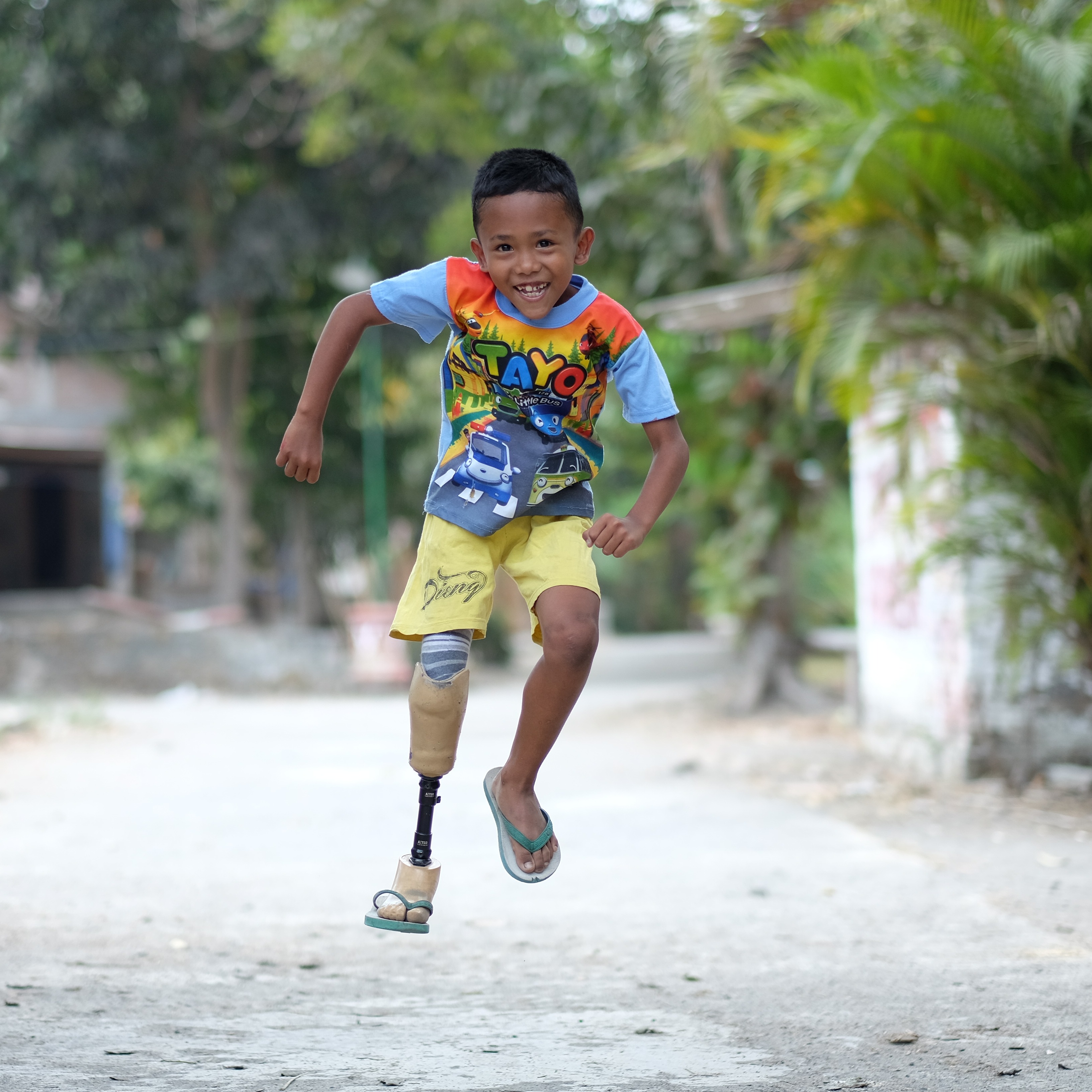 Photo 7 from A LEG TO STAND ON