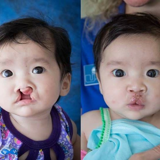 UPLIFT INTERNATIONALE