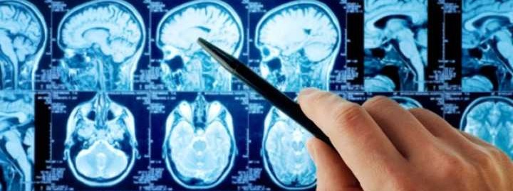 The Broach Foundation for Brain Cancer Research cover