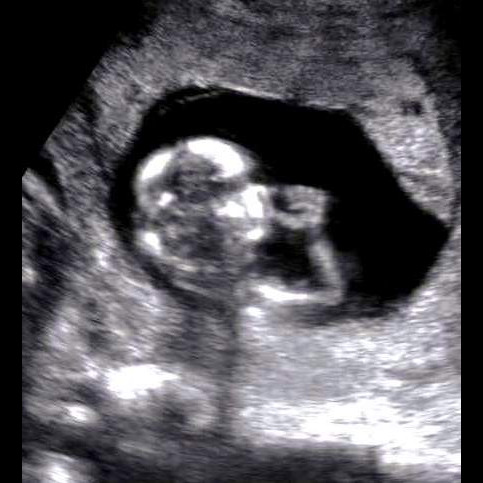 Photo 1 from West Virginians for Life Inc