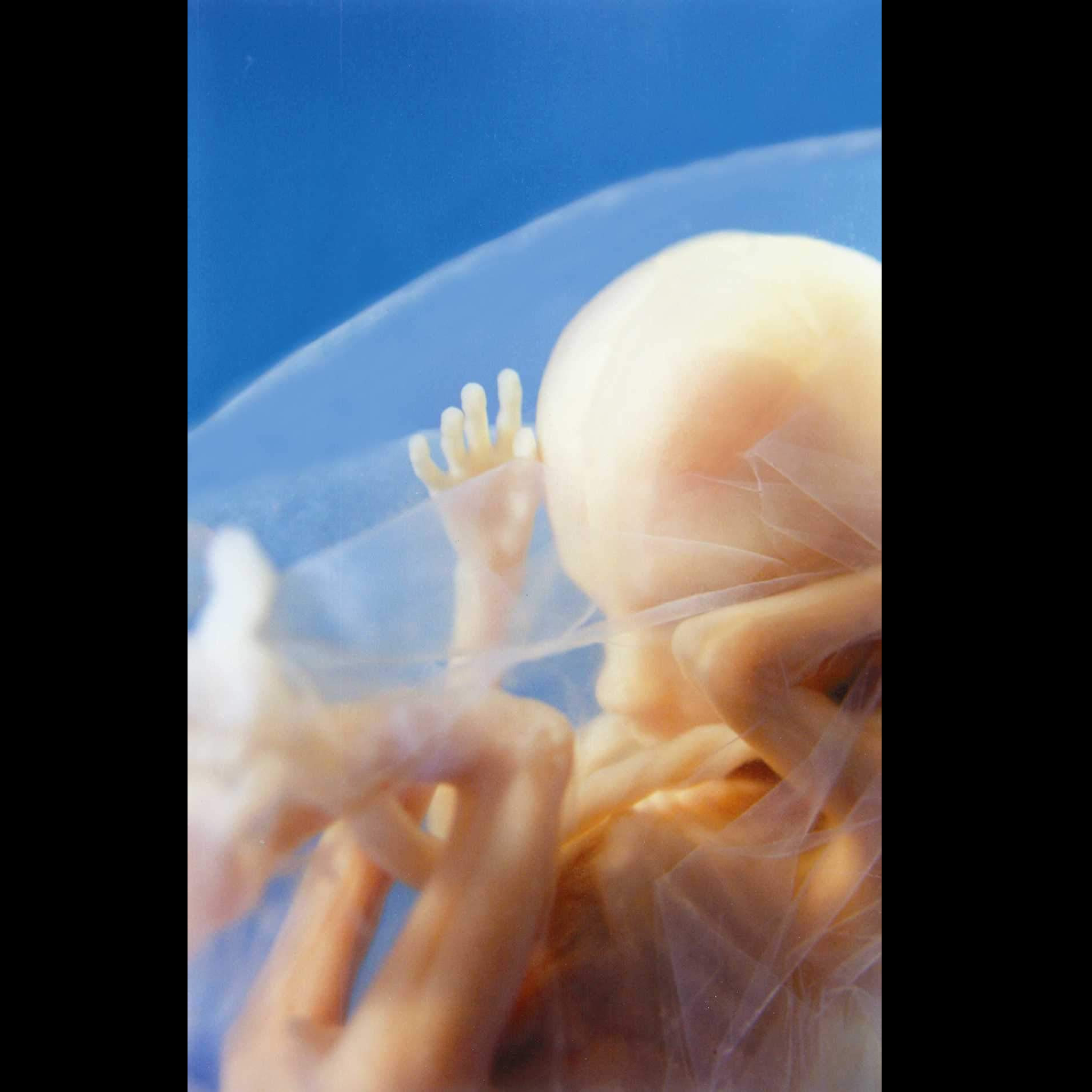 Photo 2 from West Virginians for Life Inc