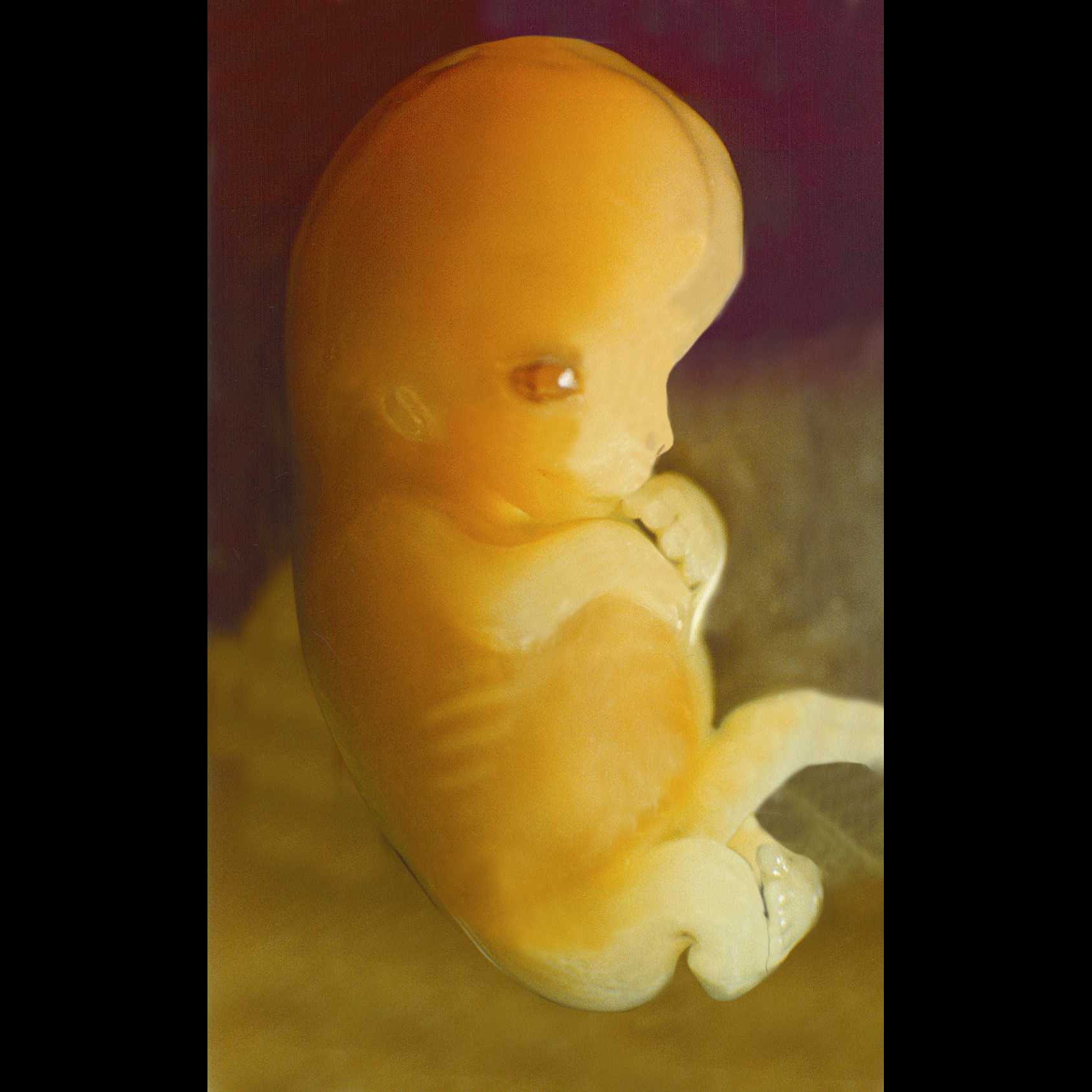 Photo 5 from West Virginians for Life Inc