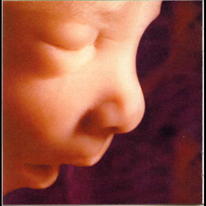 Photo 6 from West Virginians for Life Inc