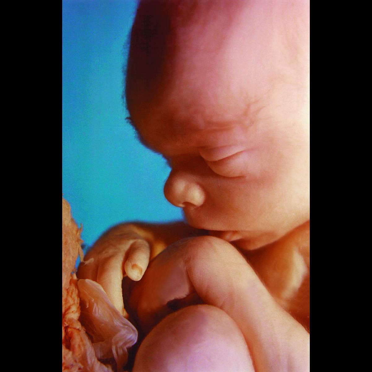 Photo 7 from West Virginians for Life Inc