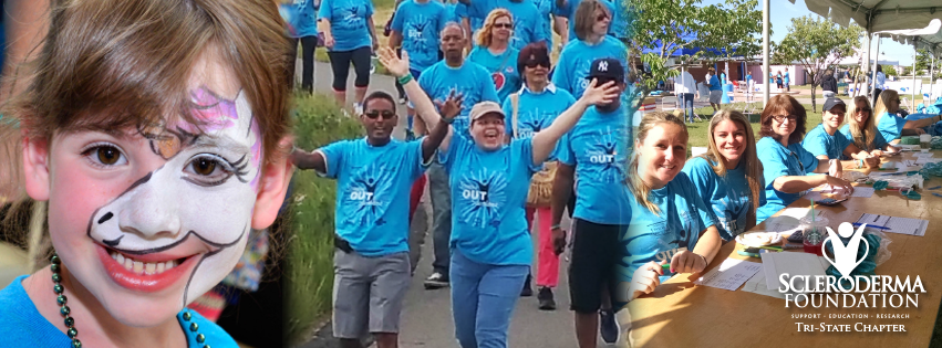 SCLERODERMA FOUNDATION TRI-STATE CHAPTER